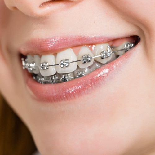 تقويم الأسنان في صفوة المهيدب لطب الأسنان