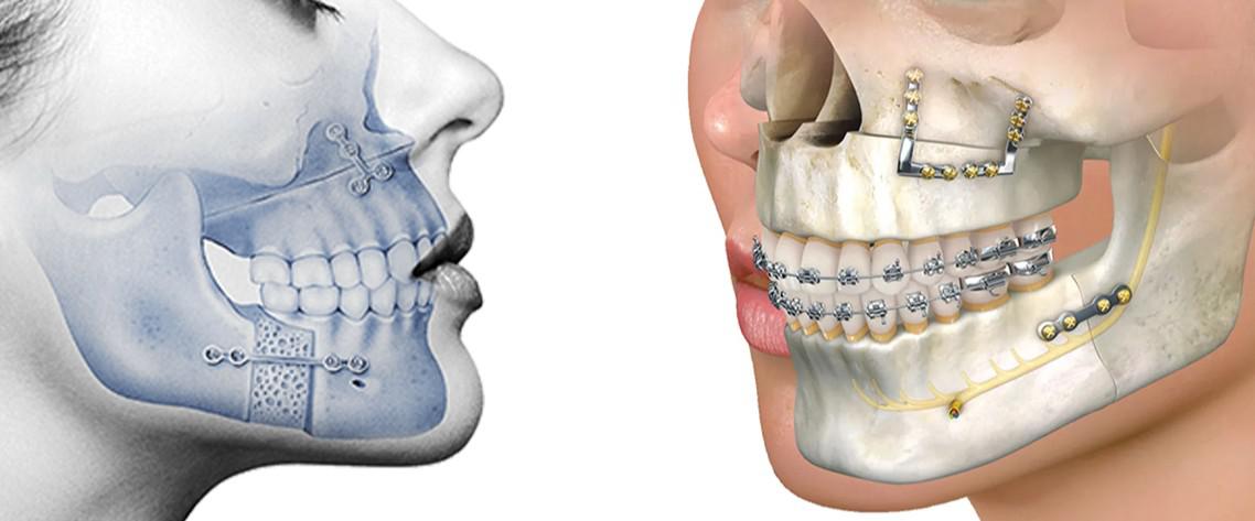 جراحة الوجه والفكين في صفوة المهيدب